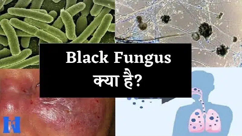 Black-Fungus-क्या-है.jpg